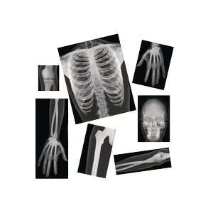  Human X Rays   Set of 18 