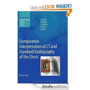 Comparative Interpretation of CT and Standard Radiography of the Chest 