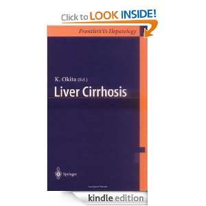 Liver Cirrhosis K. Okita  Kindle Store