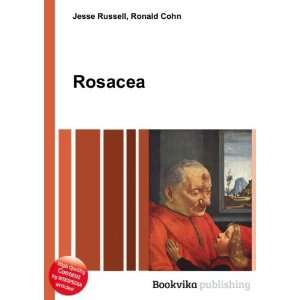 Rosacea Ronald Cohn Jesse Russell  Books